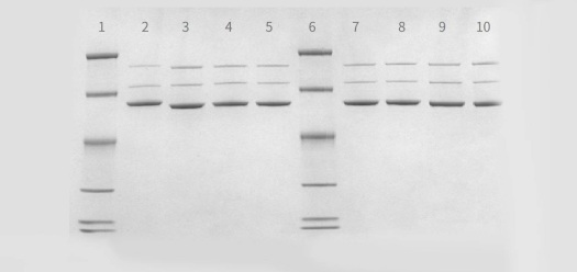Lanes 2-5 and 7-1: AAV samples produced at PackGene. Lane 1,6: Marker