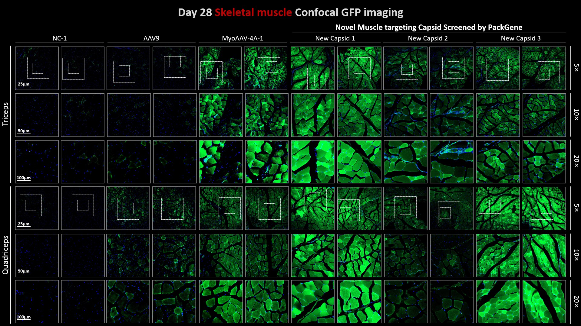 Day-28-Skeletal-muscle-Confocal-GFp-imaging
