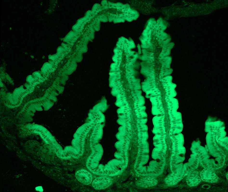 LNPEGFP-mRNA-2