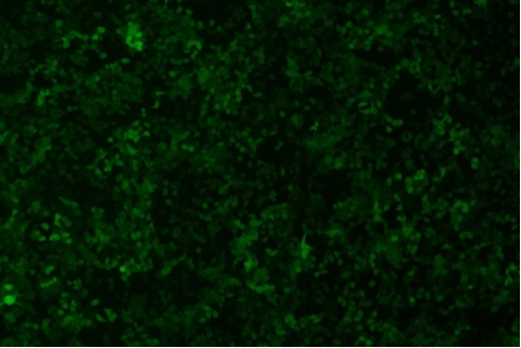 transduction-test-fluorescent-field5